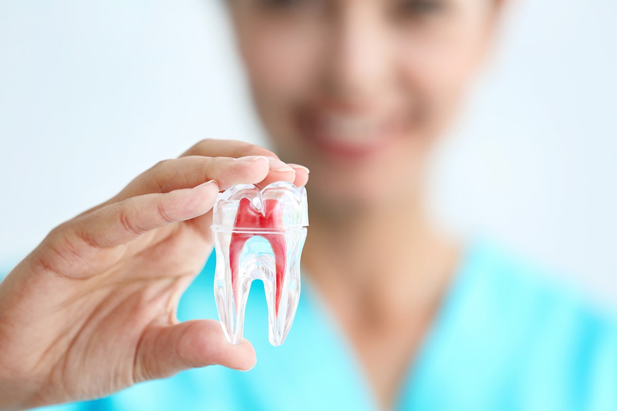 Endodoncia Diferencial01