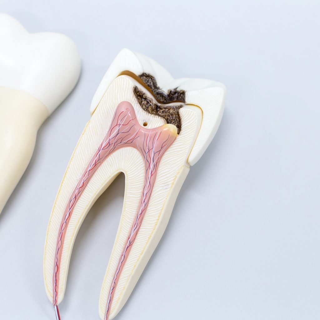 Endodoncia Main