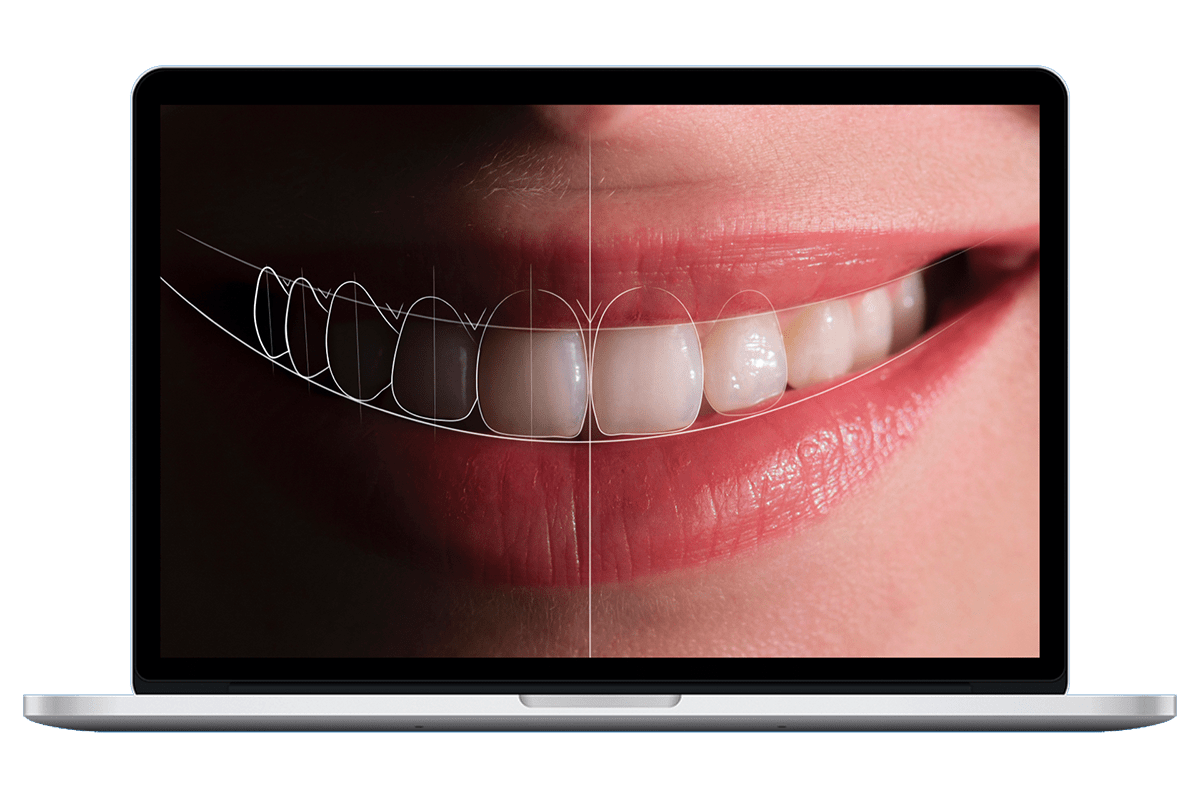 Estetica Dental Dsd01