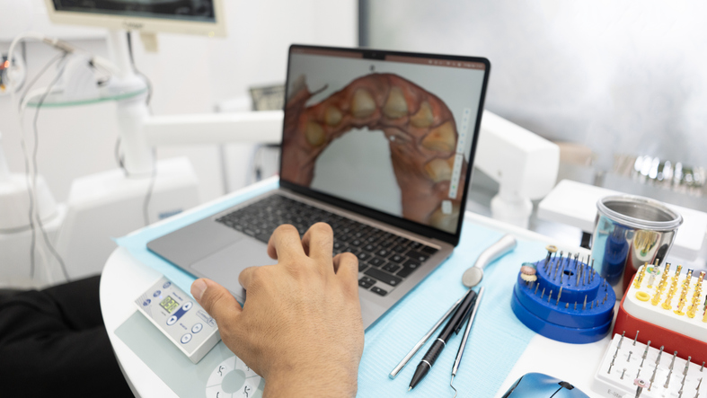 Man Hand Examining 3d Teeth Scan On Laptop In Dental Clinic