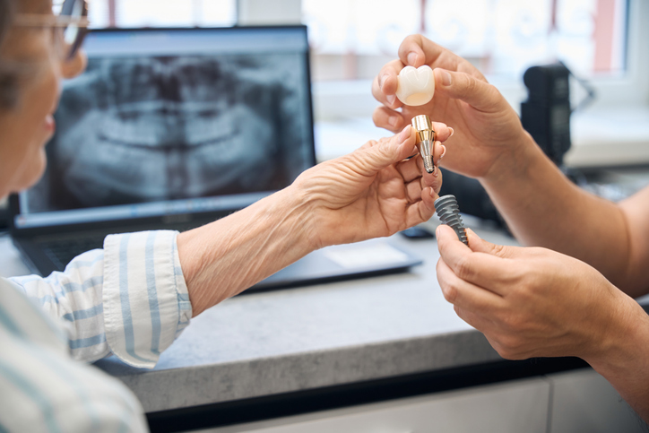 mantenimiento de implantes dentales