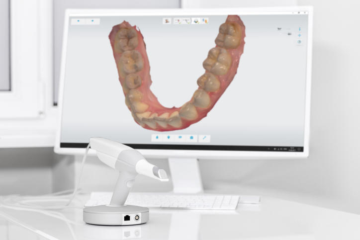 beneficios de la odontología digital