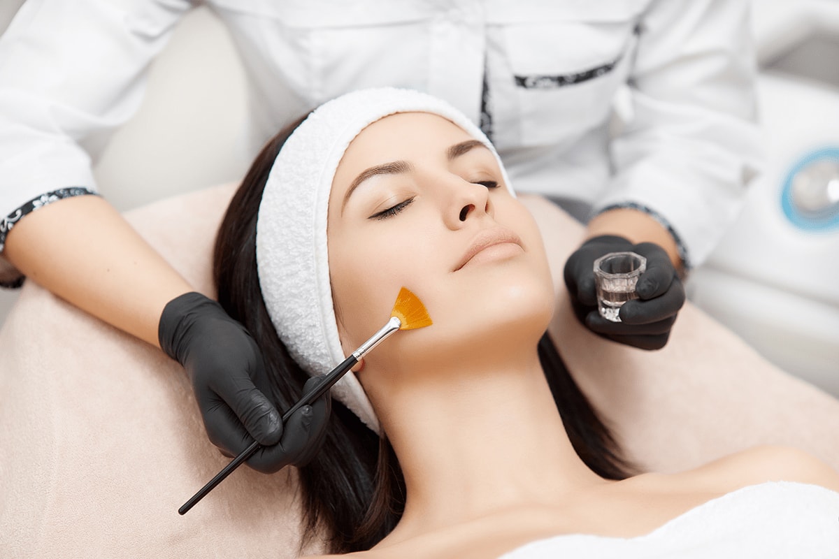 Peeling Quimico Acerca