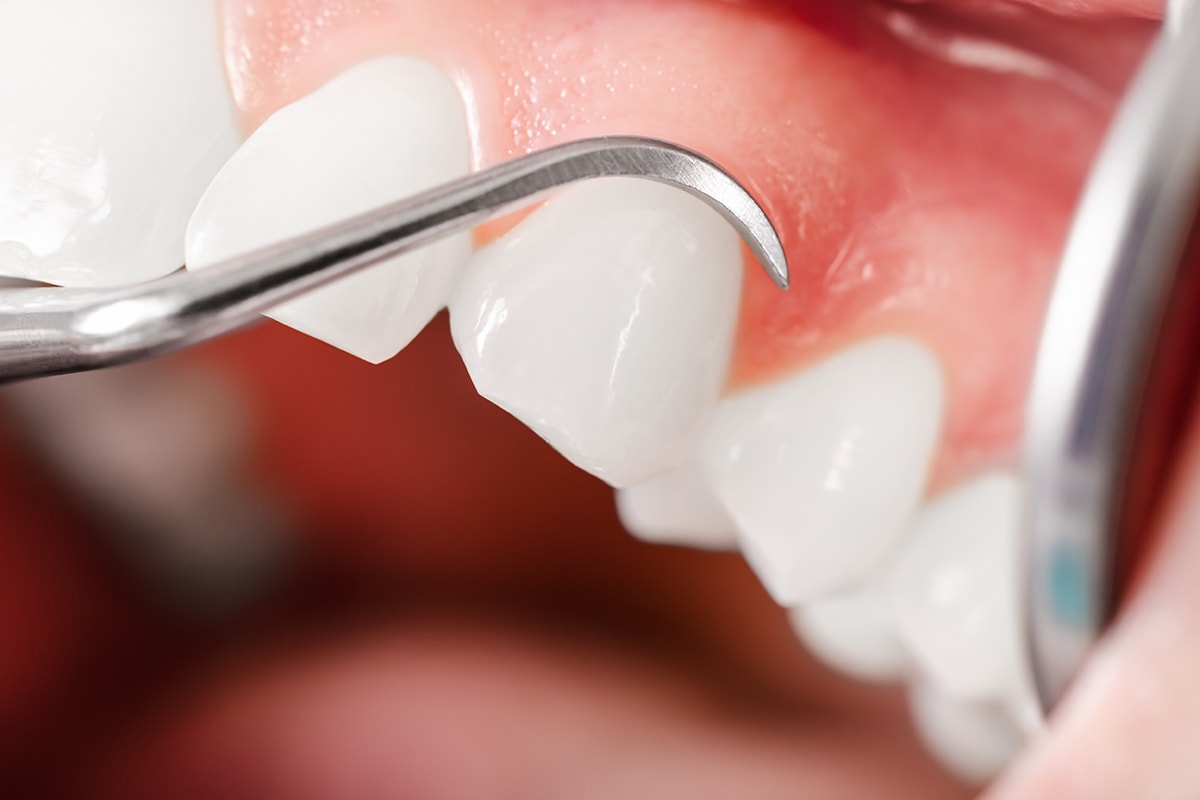 Periodoncia Acerca