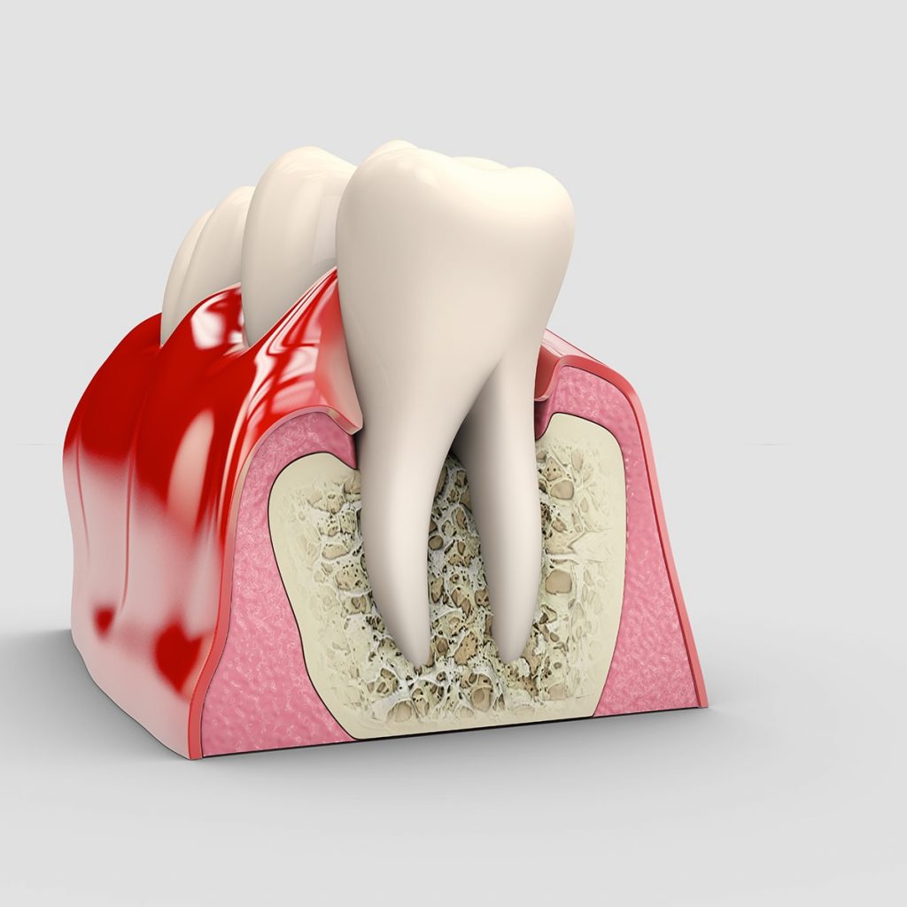 Periodoncia Main