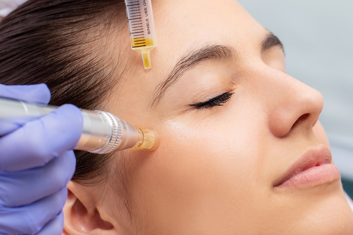 Vitaminas Faciales Infiltraciones01