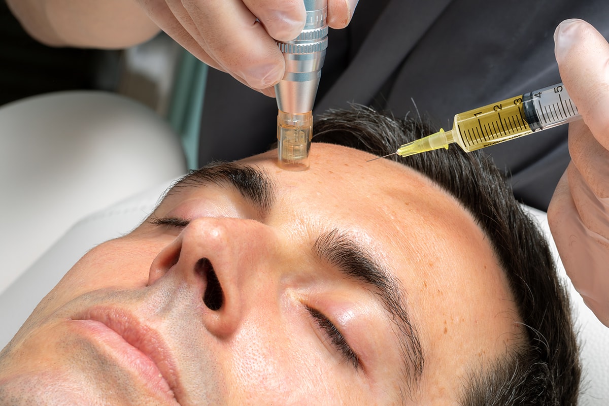 Vitaminas Faciales Infiltraciones02